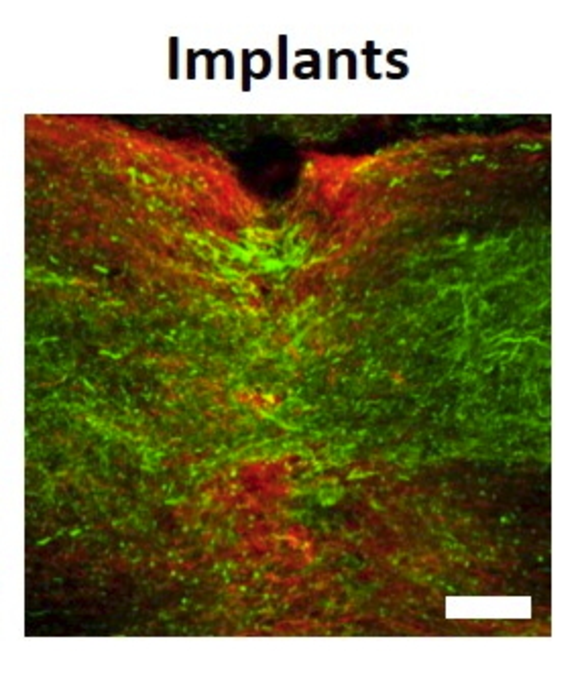 Visualization of a spinal cord with treatment