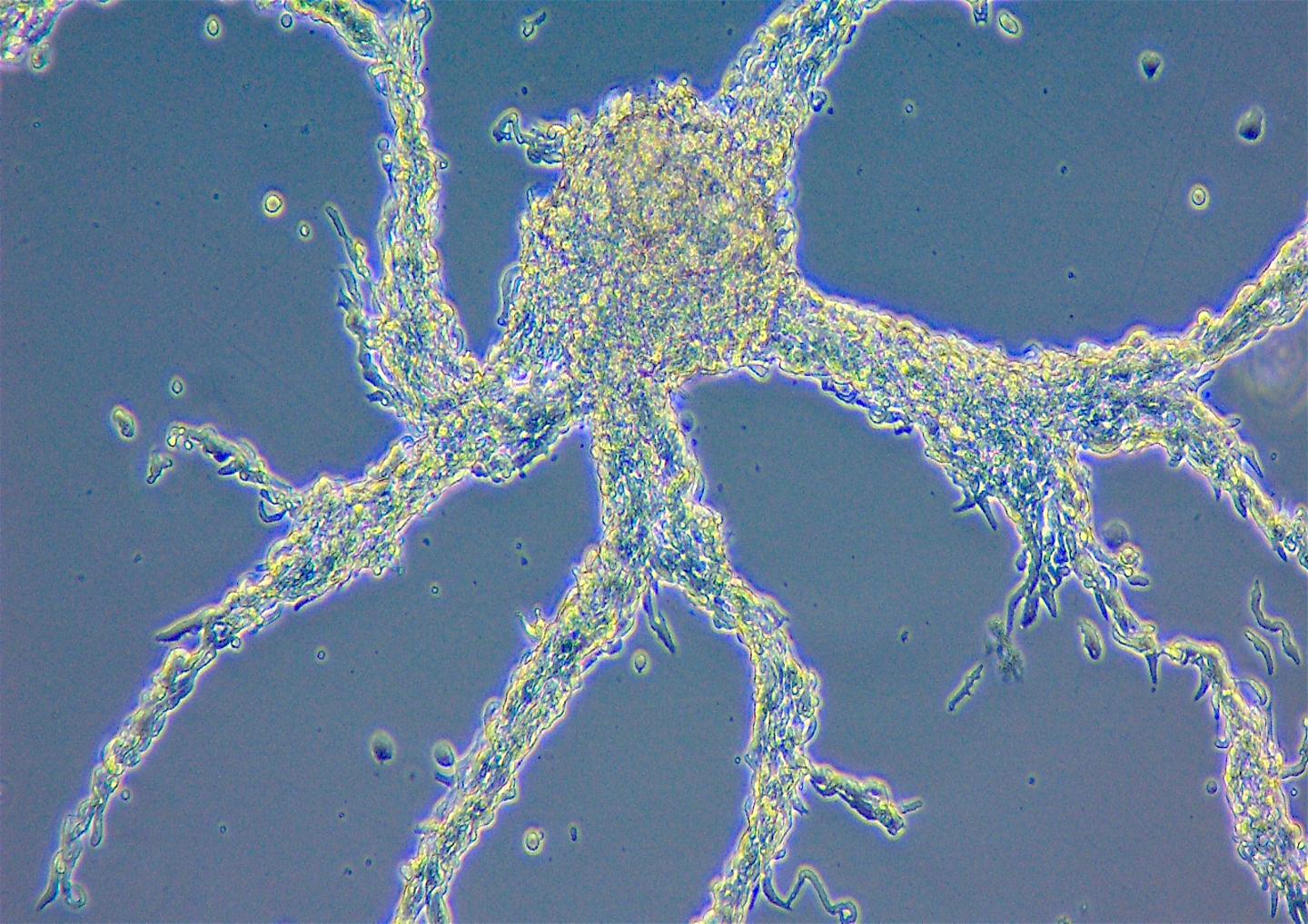 Microscopy image of the slime mold Dictyostelium discoideum