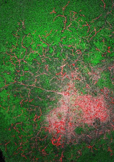Surface of a Leaf Infected by <I>Phytophthora infestans</I>