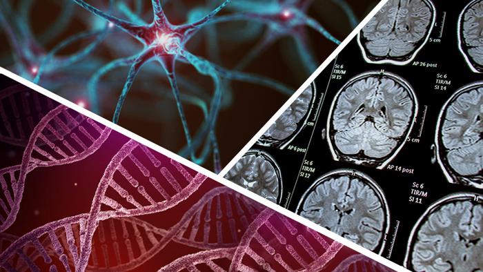 Biologically-based model to classify Parkinson's