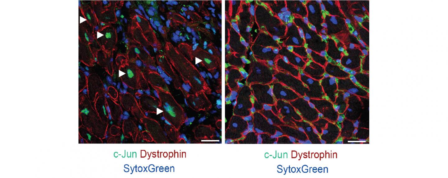 Response to Damage from a Heart Attack in the Mouse Border Zone