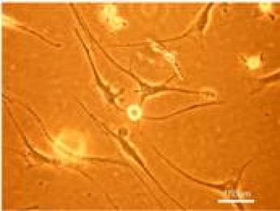 Wharton's Jelly Mesenchymal Stem Cells
