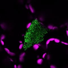 Pathogenic Bacteria Inside a Host Plant