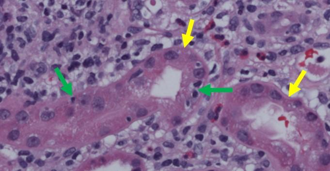 kidney tubule