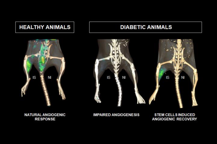MSC Treatment for PAD