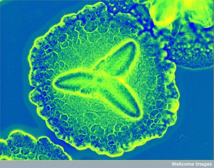 Periodontitis Culprit Aggregatibacter actinomycetemcomitans