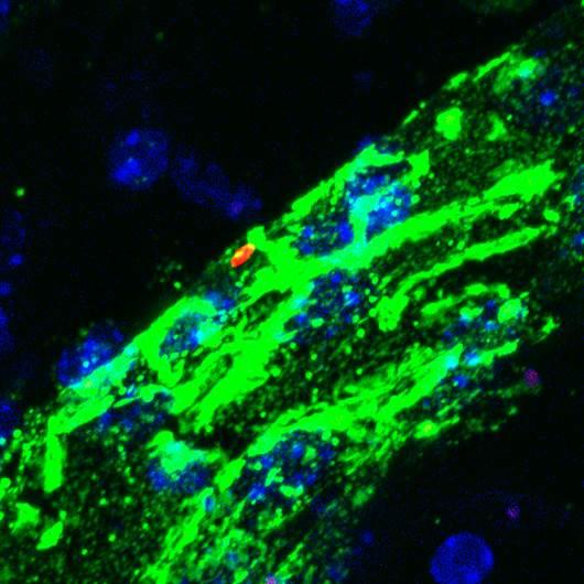 <i>Yersinia pestis</i> in the Lymph Node