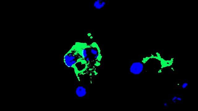 Microglia, University of California San Diego School of Medicine