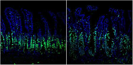 Immunofluorescent Stained Mouse Intestine