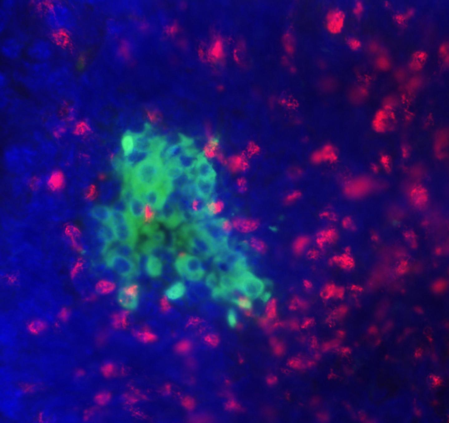 Increasing Regulatory T Cells