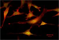Mouse Fibroblasts on Univ. of Delaware Hydrogel