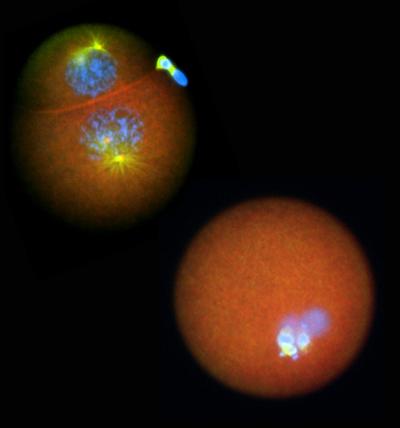 Damaged Nucleolinus, Surf Clam Egg (Fertilized Lasered)