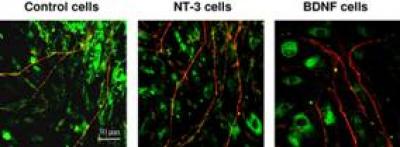 Spiral Ganglion Neurites