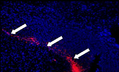 Mesenchymal Stem Cells