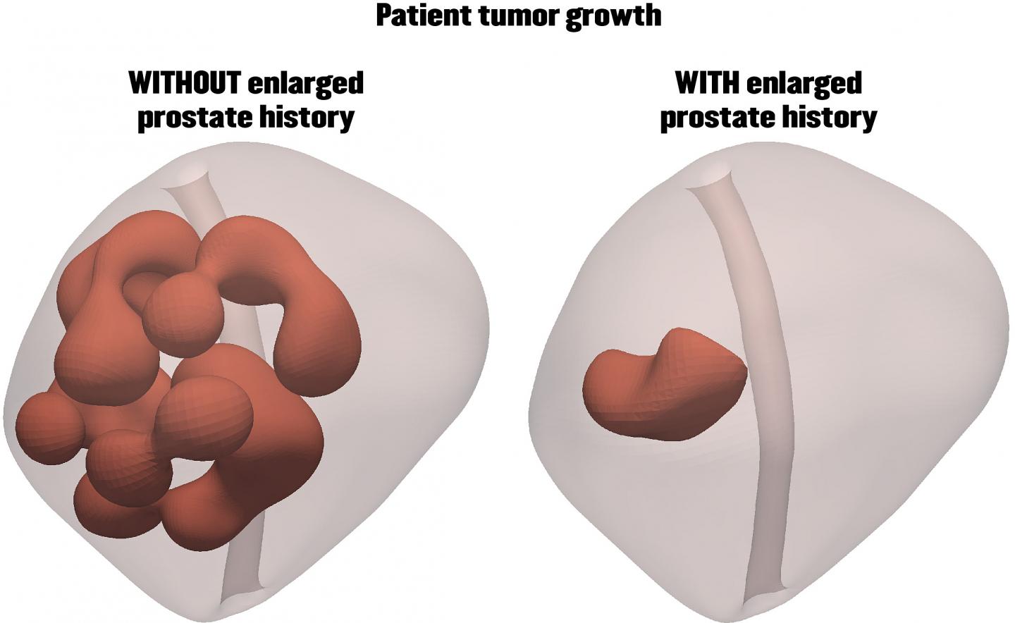 Simulations of the Prostate
