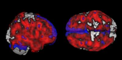 Brain Composite Image (2 of 2)