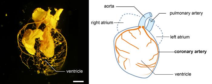 coronary artery anatomy diagram