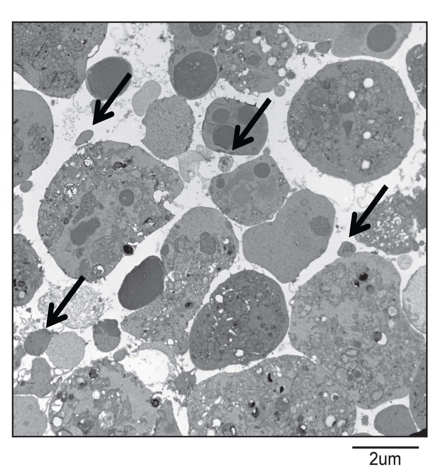 Vesicles Identified as Culprit Behind Transplant Rejection