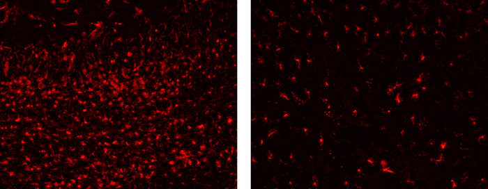 Researchers identify cells causing neuronal death in a mitochondrial disease animal model