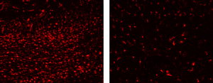 Researchers identify cells causing neuronal death in a mitochondrial disease animal model