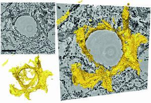 cross sections of lung tissue in grey and yellow