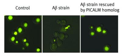 Amyloid beta Disrupts Normal Cellular Trafficking