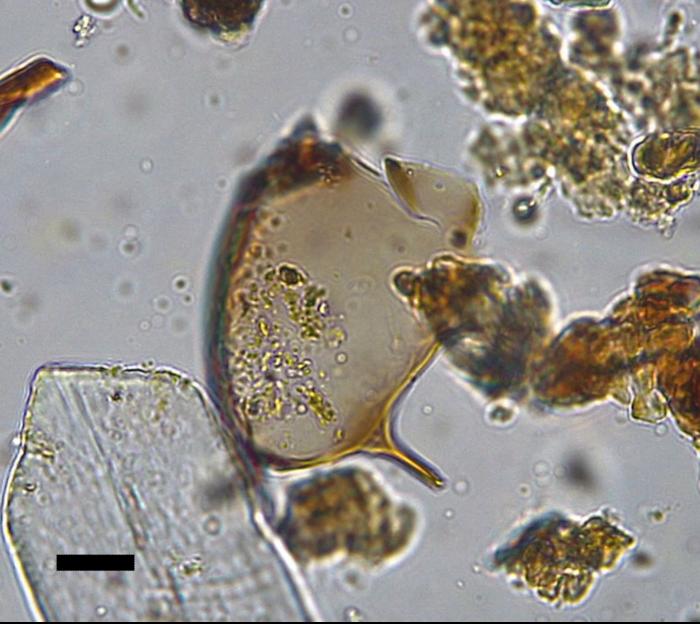 Schistosoma mansoni egg