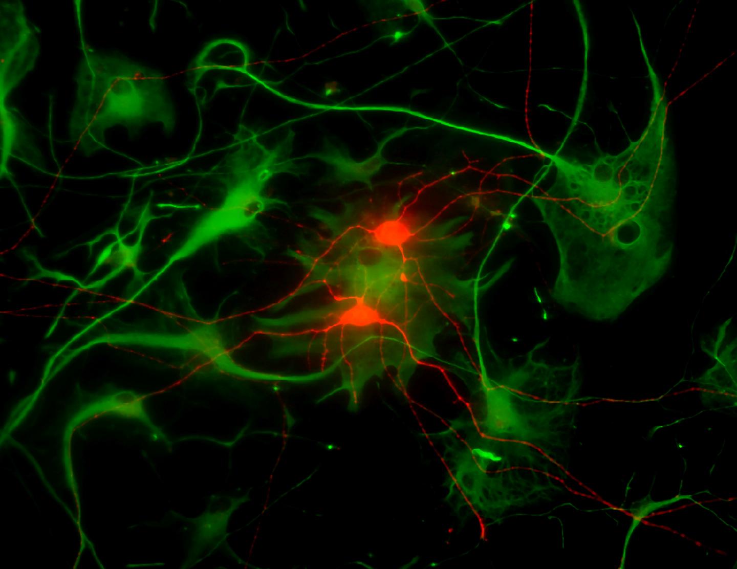 RGCs and Astrocytes