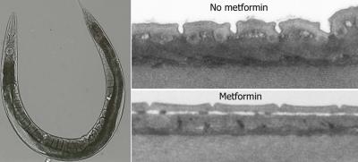 The Effect of Metformin on <i>C. elegans</i>