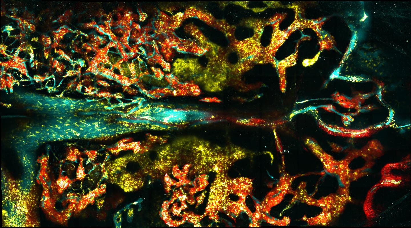 Image of Bone Marrow Environment