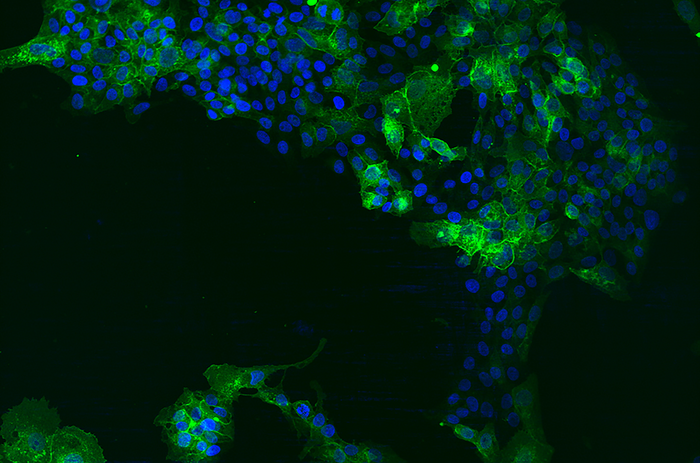 Hepatoma cells overexpressing EGFR