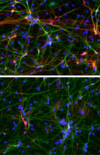 Salk Researchers Find Hallmarks of Early Brain Overgrowth in Cells of People with Autism