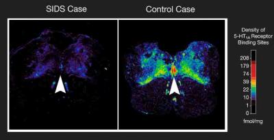 A Dearth of Receptors