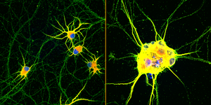 Enhanced neurons