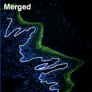 Microscopy image of HIV vaccine in tissue