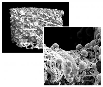 Better survival of implanted ceBetter Survival of Implanted Cells improves healing of bone fractures