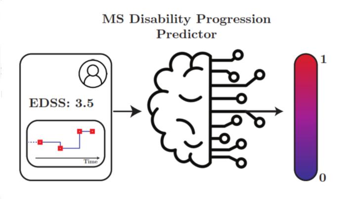 Can a computer tell patients how their multiple sclerosis will progress?