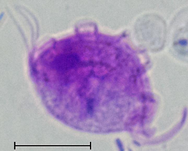 Protozoan parasite increases risk of colitis, | EurekAlert!