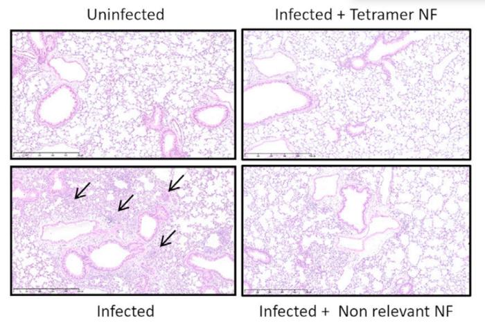Intranasal administration of nanofitin inhibits SARS-CoV-2 virus in animal models