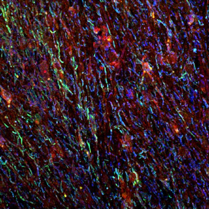 Immunofluorescence Imaging of Human Brain Tissue