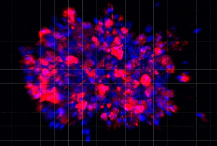 Scientists Use Organoid Model to Identify Potential New Pancreatic Cancer Treatment