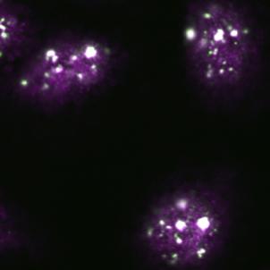 Nuclear Stress Bodies in Stressed Cells