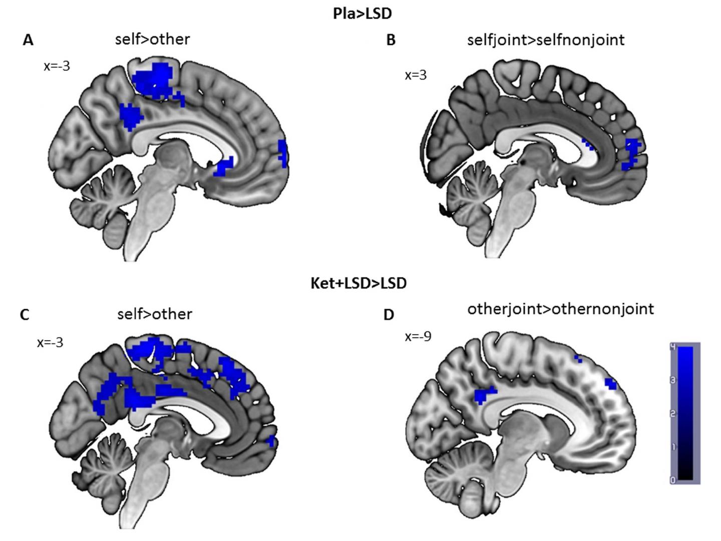 Lsd Blurs Boundary Between Self And Other Eurekalert