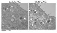 Figure 2. Electron Microscopy Analysis of Cells Expressing Control ShRNA of Myoferlin shRNA