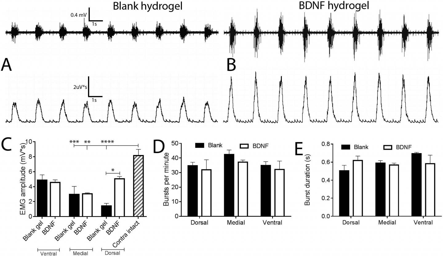 Breathing Drug Delivery