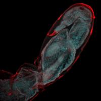 Regenerating Crustacean Leg