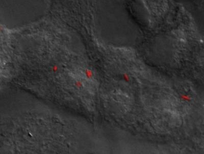 Macrophages with Typhoid Bacteria