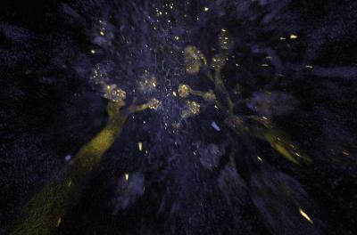 Kidney Cells Imaged Using New Tissue Clearing Techniqe