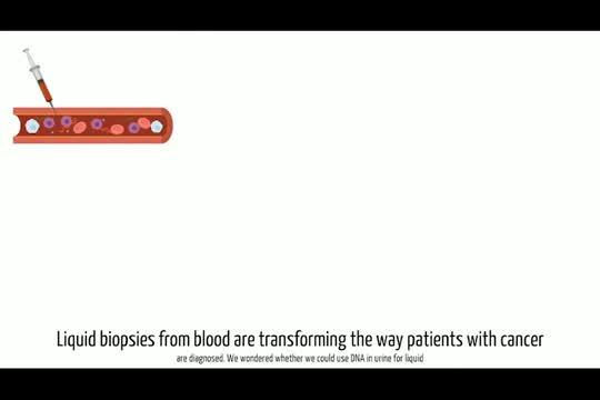 DNA in urine for liquid biopsy of cancer