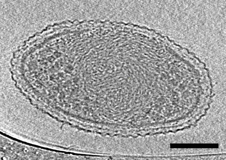 First Detailed Microscopy Evidence of Bacteria at the Lower Size Limit of Life